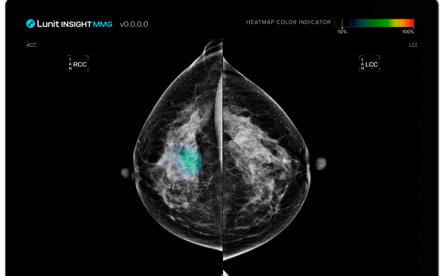 루닛 유방촬영술 AI 영상분석 솔루션 ‘루닛 인사이트 MMG’의 유방암 조기 발견·의료진 업무 경감 효과를 입증한 유럽 연구 2건이 세계적 권위의 의학 저널에 게재됐다. /루닛